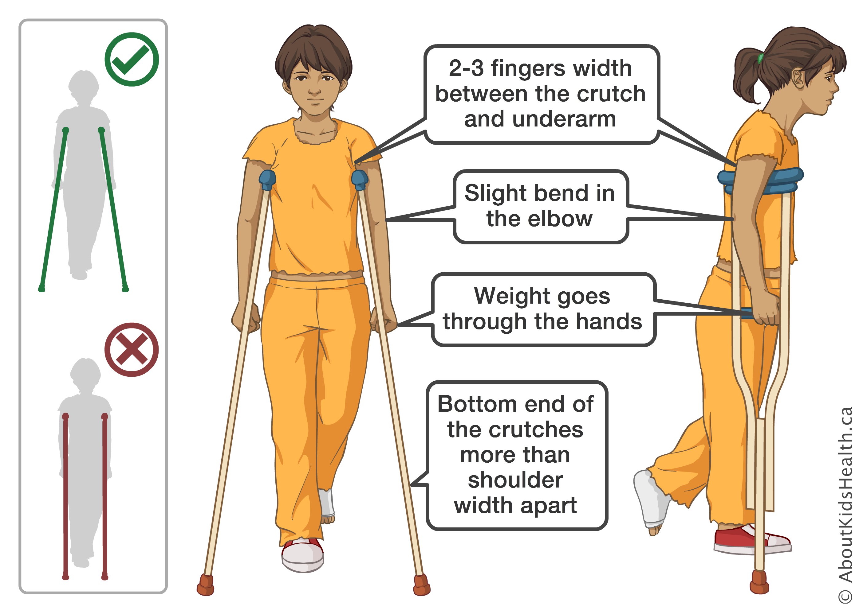 Crutch techniques demonstration